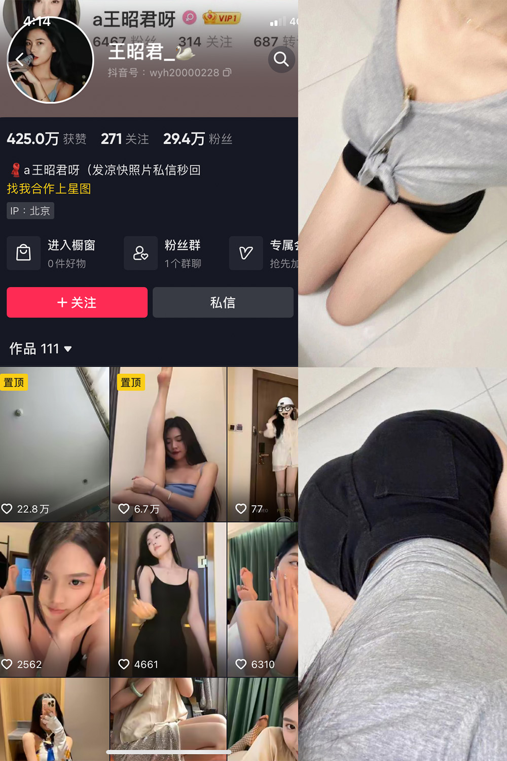 抖音 王昭君 微密圈-抖音快手觅圈