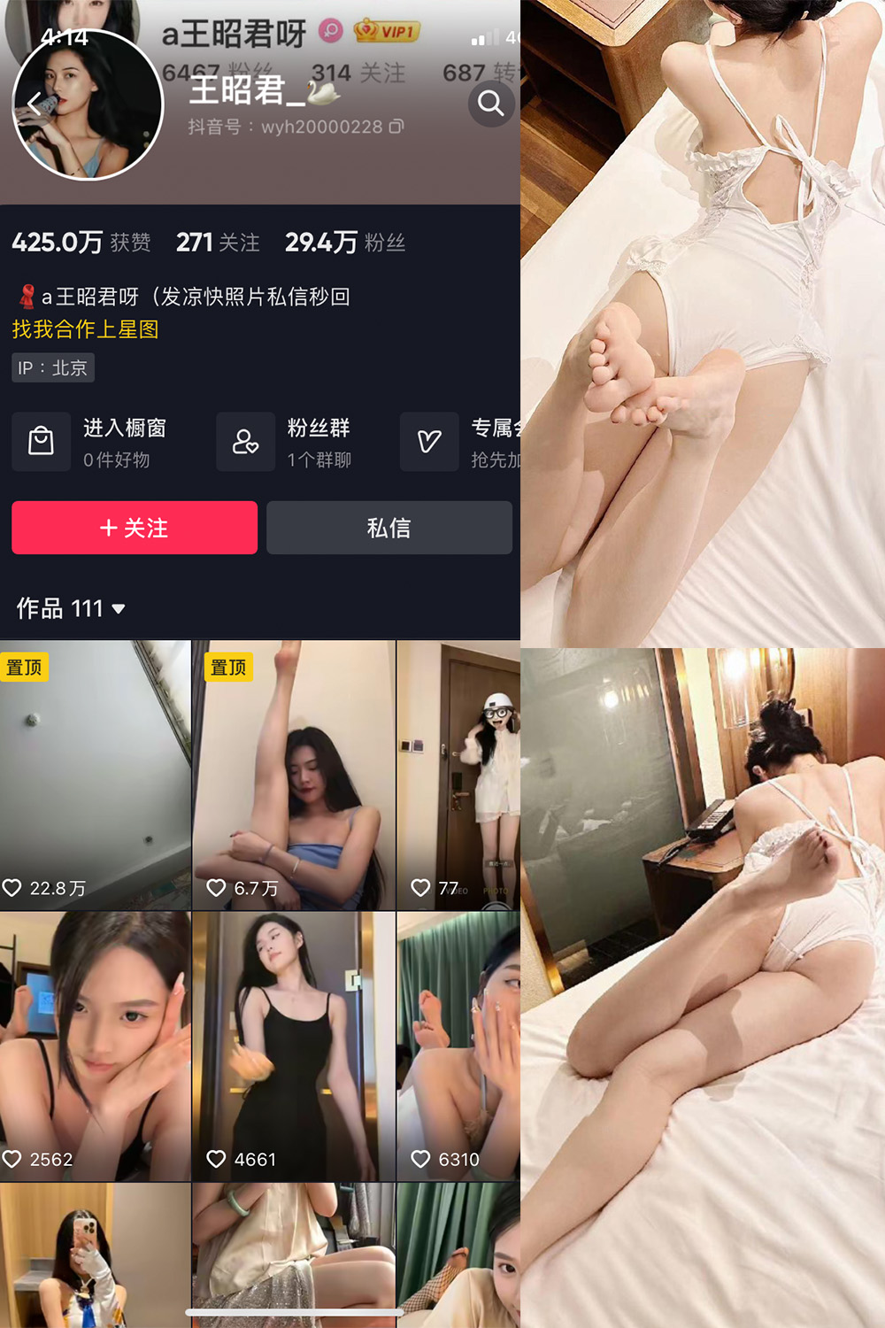 抖音 王昭君 微密圈-抖音快手觅圈